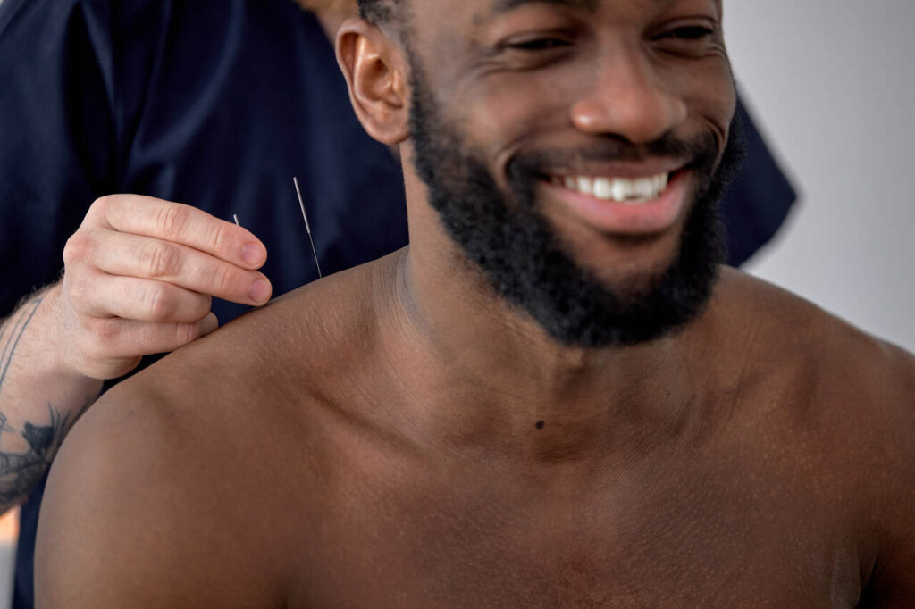 acupuncture for back pain