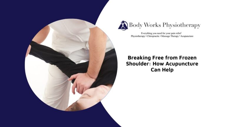 Breaking Free from Frozen Shoulder: How Acupuncture Can Help