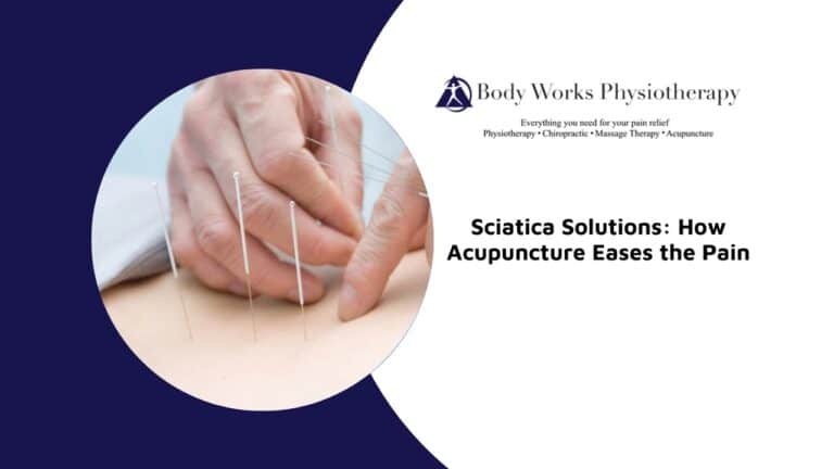 Sciatica Solutions: How Acupuncture Eases the Pain
