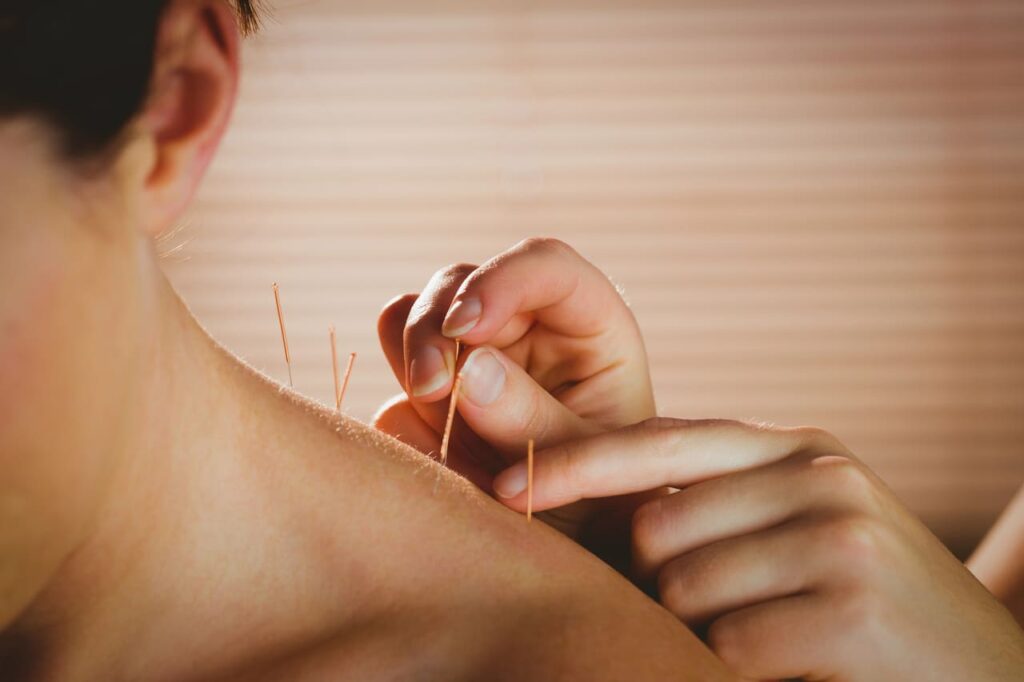 acupuncture for shoulder pain