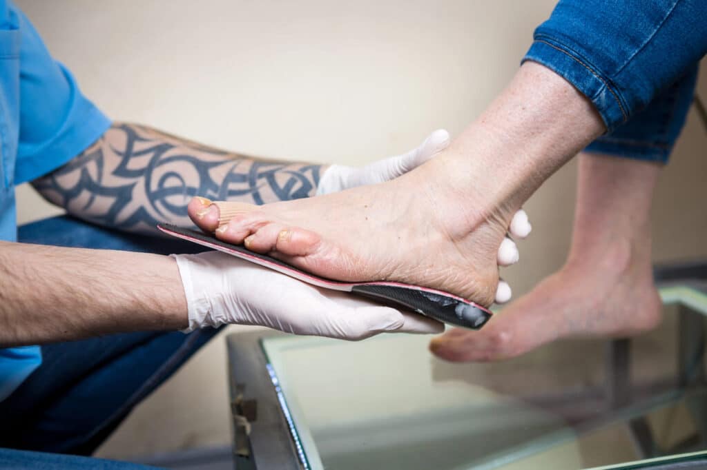 custom insoles for plantar fasciitis