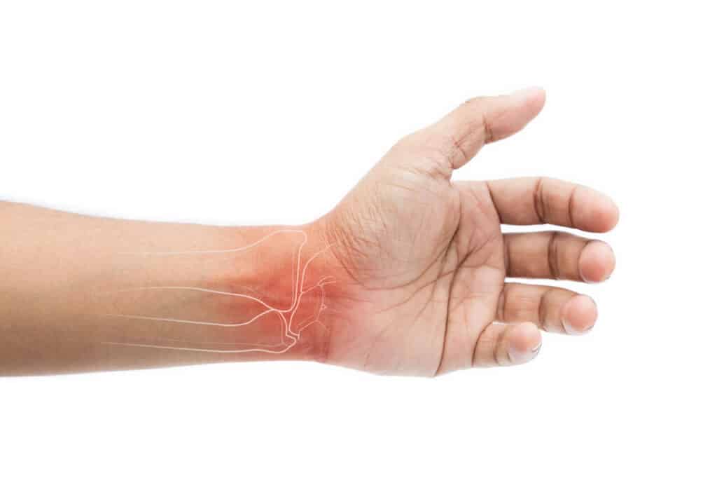 physio for carpal tunnel scarborough