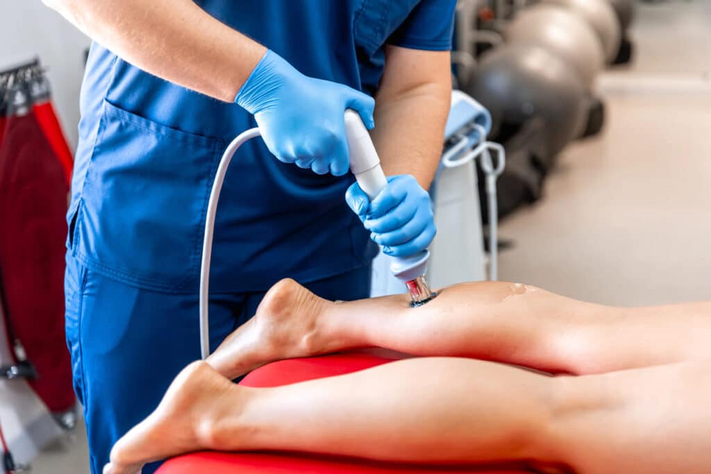 shockwave therapy for calcific tendonitis