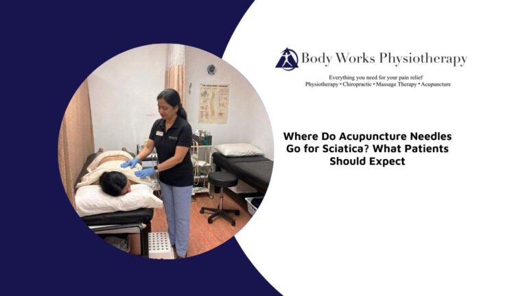 where do acupuncture needles go for sciatica scarborough