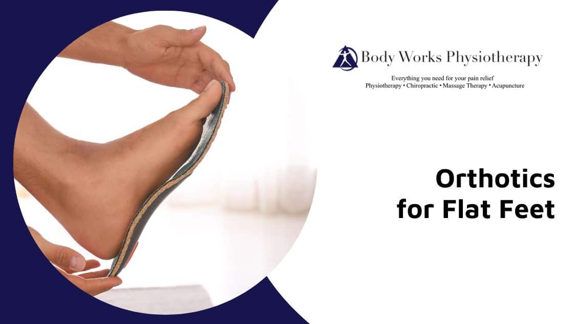 Visit Body Works Physiotherapy to Try Custom Orthotics for Flat Feet